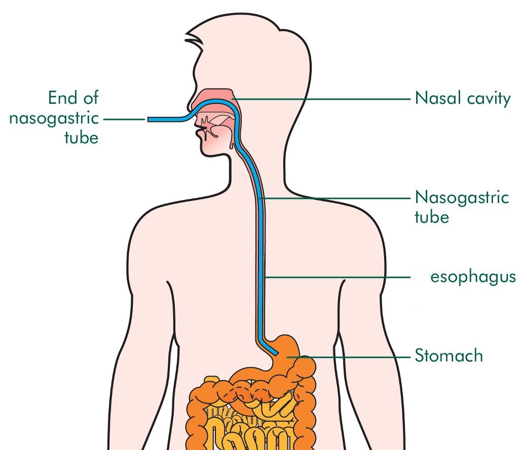 Have You Ever Tried To Force Feed A Captured Human The Atlantic